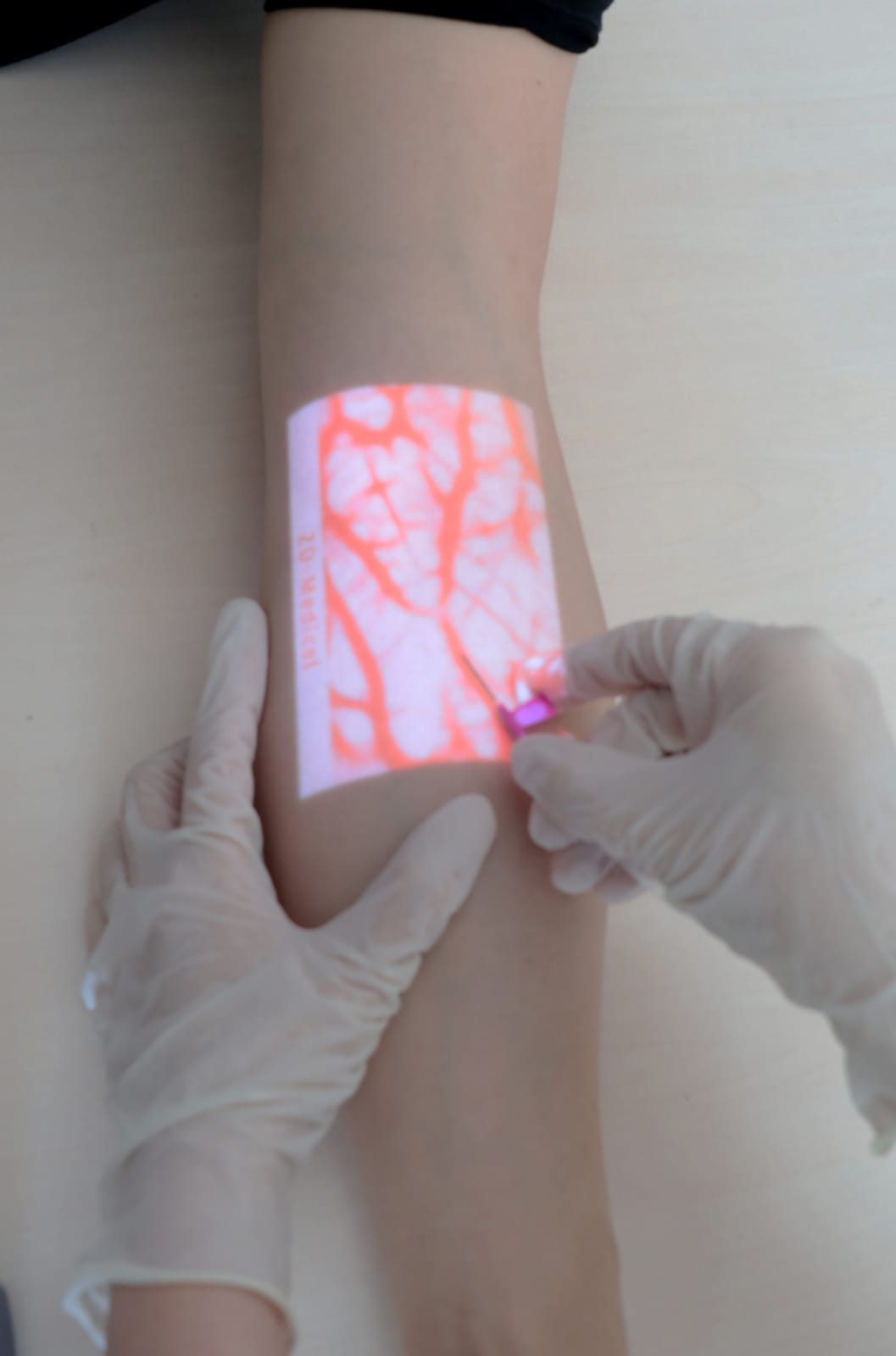 Vein Finder Real-time Vascular Projection
